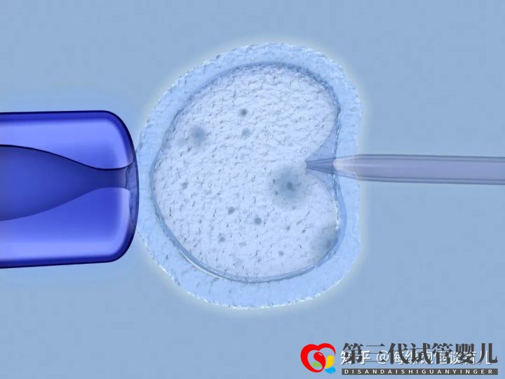 试管婴儿1代、2代、3代、4代哪个最好真实操作过...(图11)