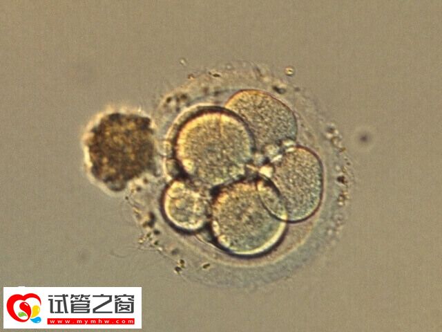 囊胚移植后雌二醇正常值比较高