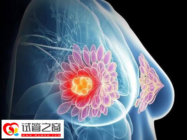 怀孕后乳房变软是正常生理现象