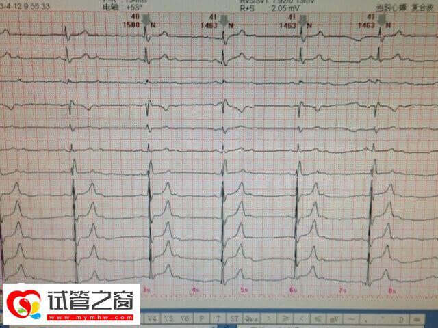 试管移植成功后要做心电图